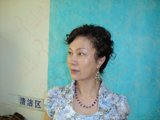 V䰸